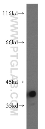 CAPG Antibody in Western Blot (WB)