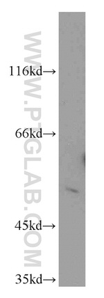 CHKA Antibody in Western Blot (WB)