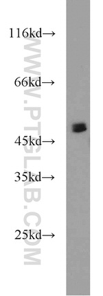 CHKA Antibody in Western Blot (WB)