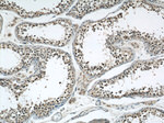 Phospho-FANCD2 (Ser330) Antibody in Immunohistochemistry (Paraffin) (IHC (P))