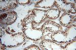 Phospho-FANCD2 (Ser330) Antibody in Immunohistochemistry (Paraffin) (IHC (P))