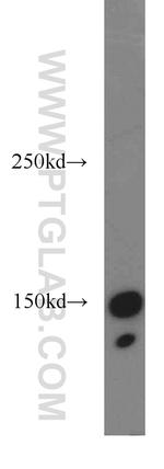 Phospho-FANCD2 (Ser330) Antibody in Western Blot (WB)