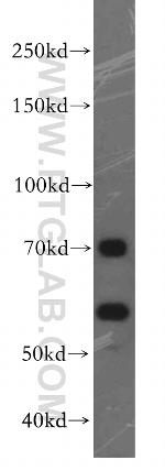 FEM1B Antibody in Western Blot (WB)