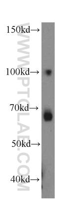 LPIN2 Antibody in Western Blot (WB)