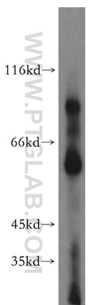 LPIN2 Antibody in Western Blot (WB)
