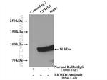 LRWD1 Antibody in Immunoprecipitation (IP)