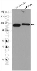 LRWD1 Antibody in Western Blot (WB)