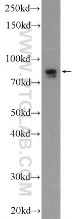 LRWD1 Antibody in Western Blot (WB)