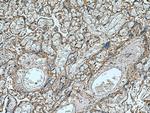 Myoferlin Antibody in Immunohistochemistry (Paraffin) (IHC (P))