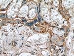 Myoferlin Antibody in Immunohistochemistry (Paraffin) (IHC (P))