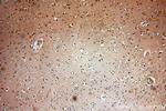 KIF19 Antibody in Immunohistochemistry (Paraffin) (IHC (P))