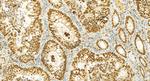 SATB2 Antibody in Immunohistochemistry (Paraffin) (IHC (P))