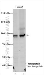 SATB2 Antibody in Western Blot (WB)