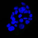 EGFR (Epidermal Growth Factor Receptor) Antibody in Immunocytochemistry (ICC/IF)