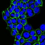 EGFR (Epidermal Growth Factor Receptor) Antibody in Immunocytochemistry (ICC/IF)