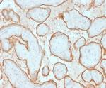 EGFR (Epidermal Growth Factor Receptor) Antibody in Immunohistochemistry (Paraffin) (IHC (P))