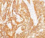 EGFR (Epidermal Growth Factor Receptor) Antibody in Immunohistochemistry (Paraffin) (IHC (P))