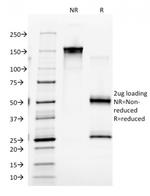 EGFR (Epidermal Growth Factor Receptor) Antibody in SDS-PAGE (SDS-PAGE)