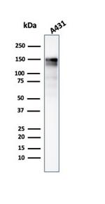 EGFR (Epidermal Growth Factor Receptor) Antibody in Western Blot (WB)