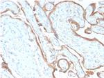 EGFR (Epidermal Growth Factor Receptor) Recombinant Rabbit Monoclonal Antibody (GFR, 2968R)