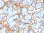 EGFR (Epidermal Growth Factor Receptor) Recombinant Rabbit Monoclonal Antibody (GFR/4563R)