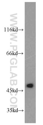 Phospho-SPHK1 (Ser225) Antibody in Western Blot (WB)