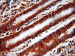 UNC45A Antibody in Immunohistochemistry (Paraffin) (IHC (P))