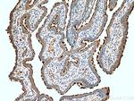 UNC45A Antibody in Immunohistochemistry (Paraffin) (IHC (P))