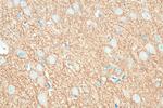 KCC2/SLC12A5 Antibody in Immunohistochemistry (Paraffin) (IHC (P))
