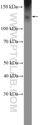 KCC2/SLC12A5 Antibody in Western Blot (WB)
