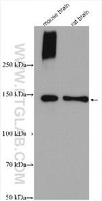 KCC2/SLC12A5 Antibody in Western Blot (WB)