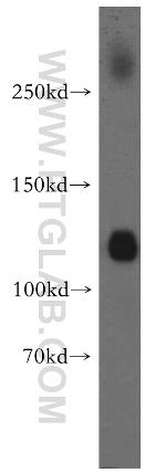 KCC2/SLC12A5 Antibody in Western Blot (WB)