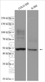 KIAA0494 Antibody in Western Blot (WB)