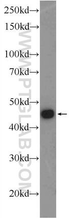 KIAA0494 Antibody in Western Blot (WB)