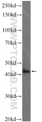 KIAA0494 Antibody in Western Blot (WB)