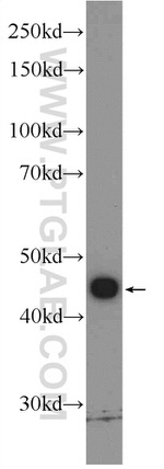 KIAA0494 Antibody in Western Blot (WB)