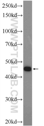 KIAA0494 Antibody in Western Blot (WB)
