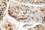 HYAL3 Antibody in Immunohistochemistry (Paraffin) (IHC (P))