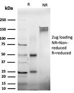 EIF2S1/EIF-2 alpha (EIF2A) Antibody in SDS-PAGE (SDS-PAGE)