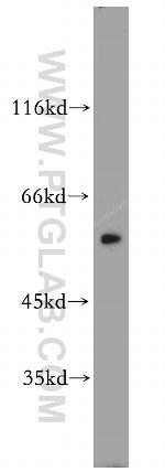 MUTYH Antibody in Western Blot (WB)