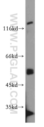 PPP3CC Antibody in Western Blot (WB)