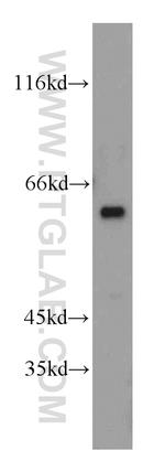 PPP3CC Antibody in Western Blot (WB)