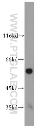 PPP3CC Antibody in Western Blot (WB)