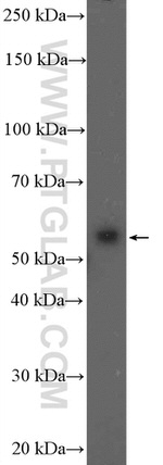 PPP3CC Antibody in Western Blot (WB)