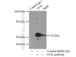 GCK Antibody in Immunoprecipitation (IP)