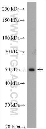 GCK Antibody in Western Blot (WB)