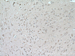 MYH10 Antibody in Immunohistochemistry (Paraffin) (IHC (P))