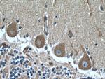 MYH10 Antibody in Immunohistochemistry (Paraffin) (IHC (P))