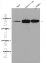 MYH10 Antibody in Western Blot (WB)