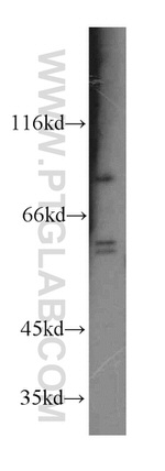 RRM1 Antibody in Western Blot (WB)